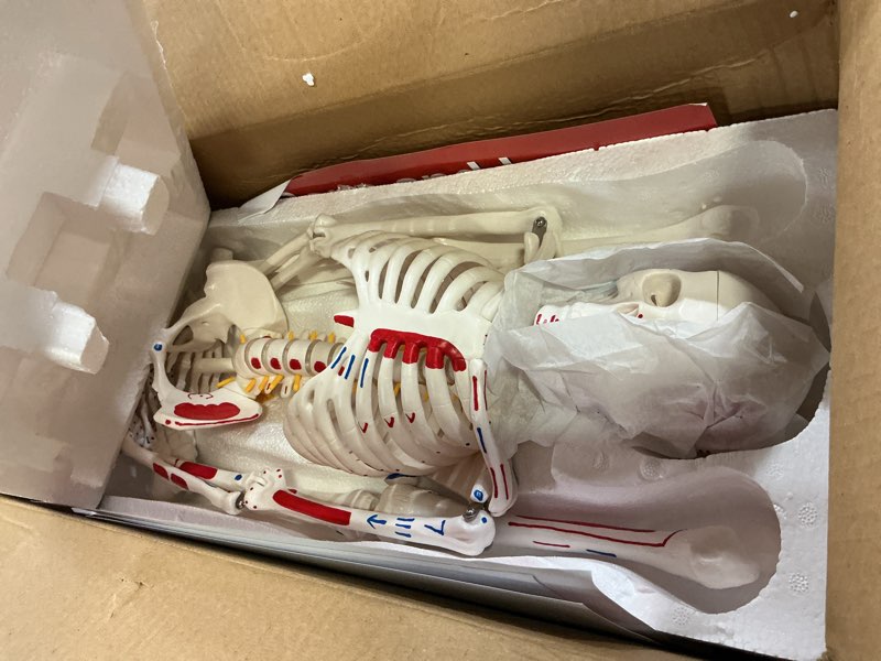 Condition photo showing As Is for TYRRDE 33.4” Human Skeleton Model with Removable Arms & Legs – Durable Mini Anatomy Model for Teaching, Scientific Study Painted with Numbered Muscle Markings & Display Base (beige)