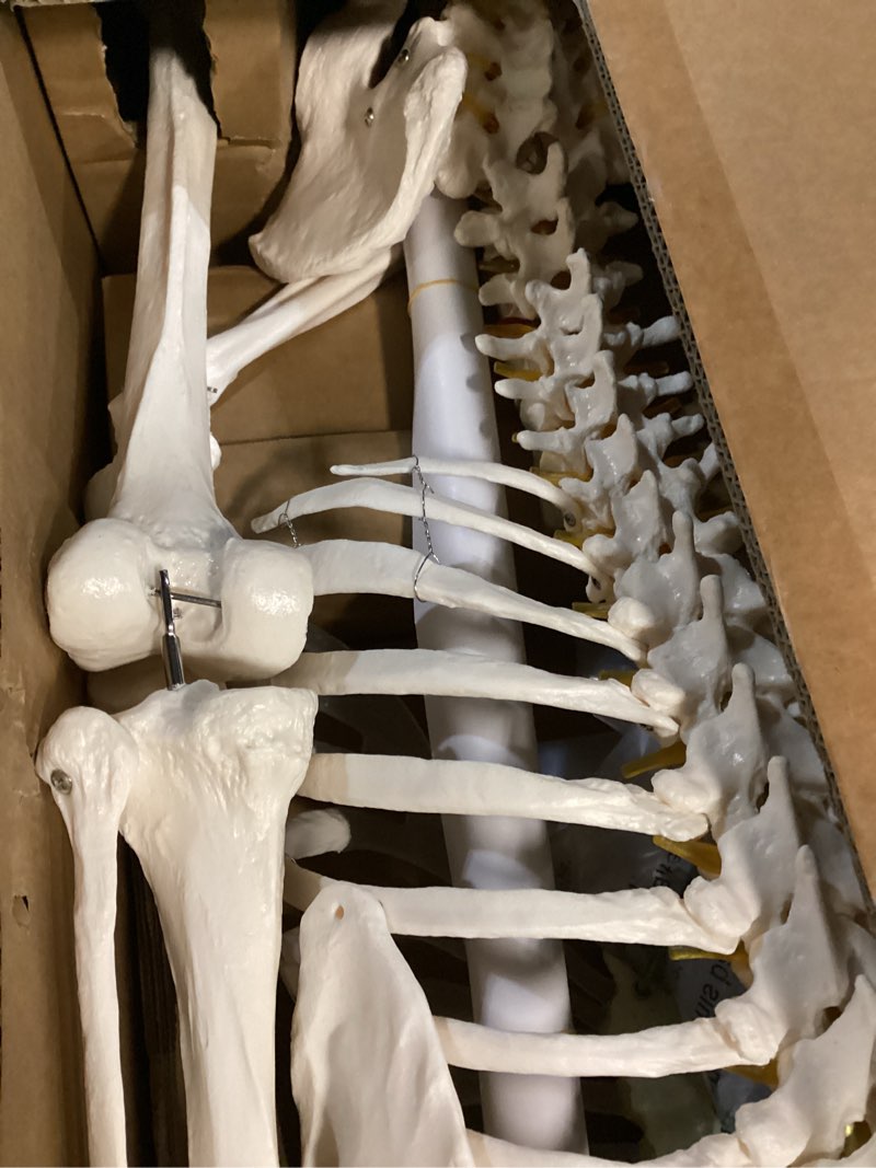 Condition photo showing New/Like New for breesky Human Skeleton Model for Anatomy- Life Size Medical Human Skeleton Model with Nervous System 70.8 in with Rolling Stand for Medical Study and Display 3 Posters 70.8 Inches Skeleton Model