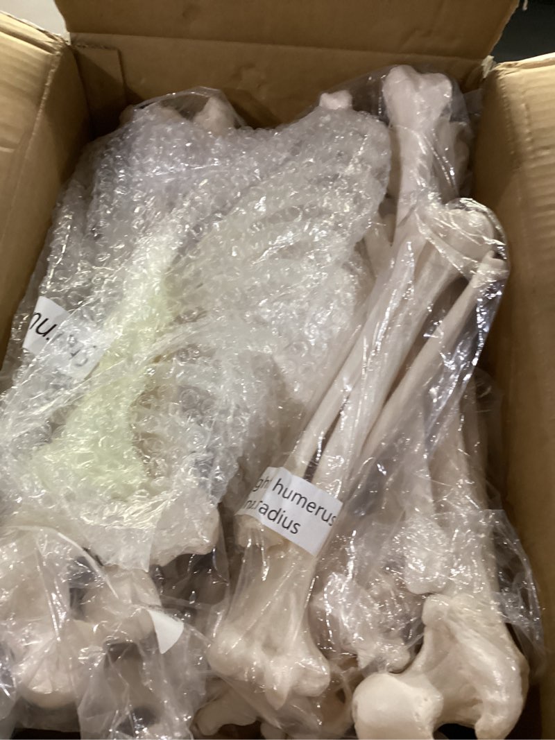 Condition photo showing Good Condition for evotech disarticulated human skeleton model for anatomy 67 inch high, full size skeleton models with skull, spine, bones, articulated hand & foot, for anatomy medical learning