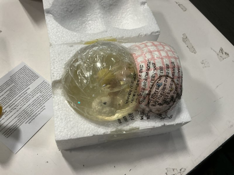 Condition photo showing Good Condition for Precious Moments, Jesus Loves Me, Snow Globe, Resin, Girl, 102403