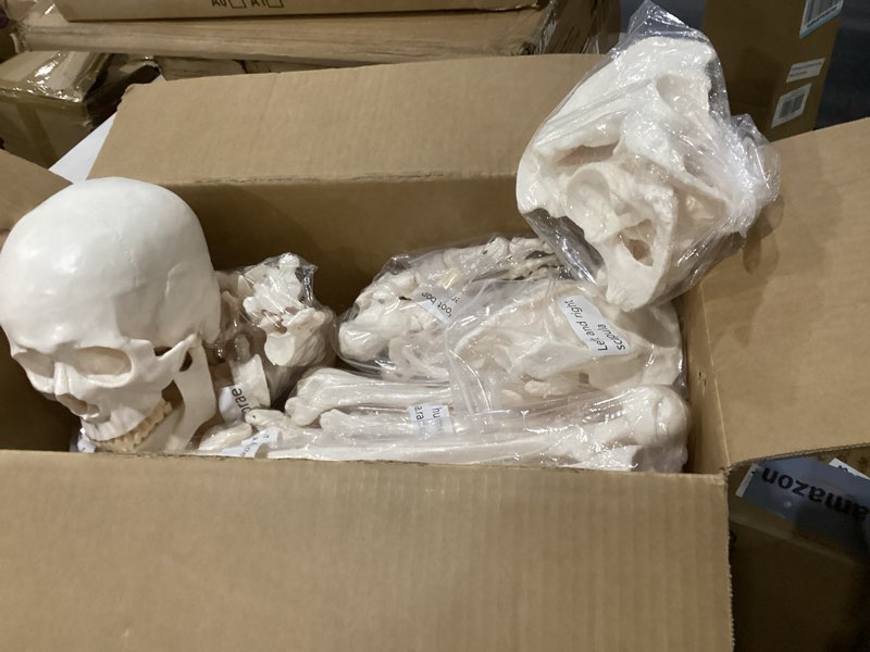 Condition photo showing New/Like New for similar to stock photo life size posable skeleton for anatomy, 70.8'' human skeleton bones full size skeleton model with nervous system & carotid artery, medical pvc anatomy skeleton model w/rolling stand for study display 70.8\" skeleton rolling stand