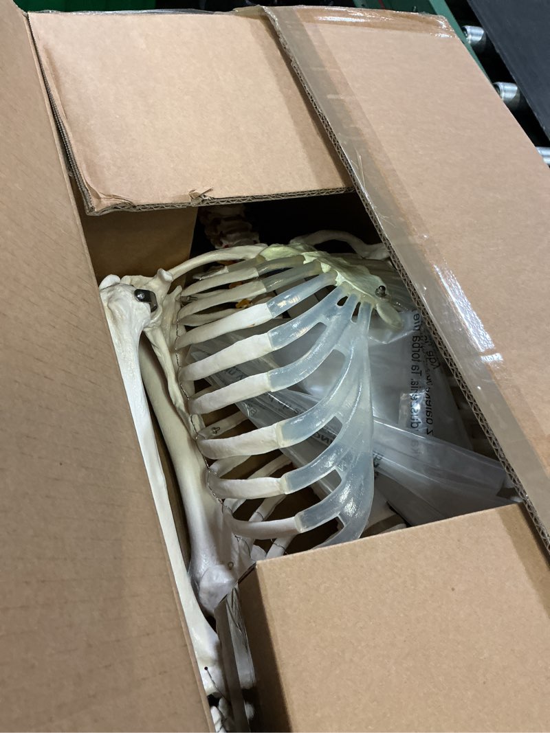 Condition photo showing Good Condition for breesky human skeleton model for anatomy- life size medical human skeleton model with nervous system 70.8 in with rolling stand for medical study and display 3 posters 70.8 inches skeleton model