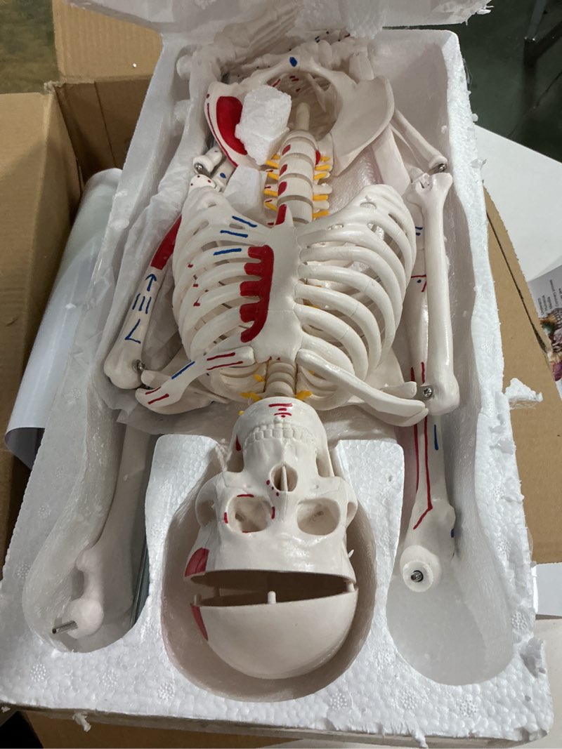 Condition photo showing Good Condition for TYRRDE 33.4” Human Skeleton Model with Removable Arms & Legs – Durable Mini Anatomy Model for Teaching, Scientific Study Painted with Numbered Muscle Markings & Display Base (beige)