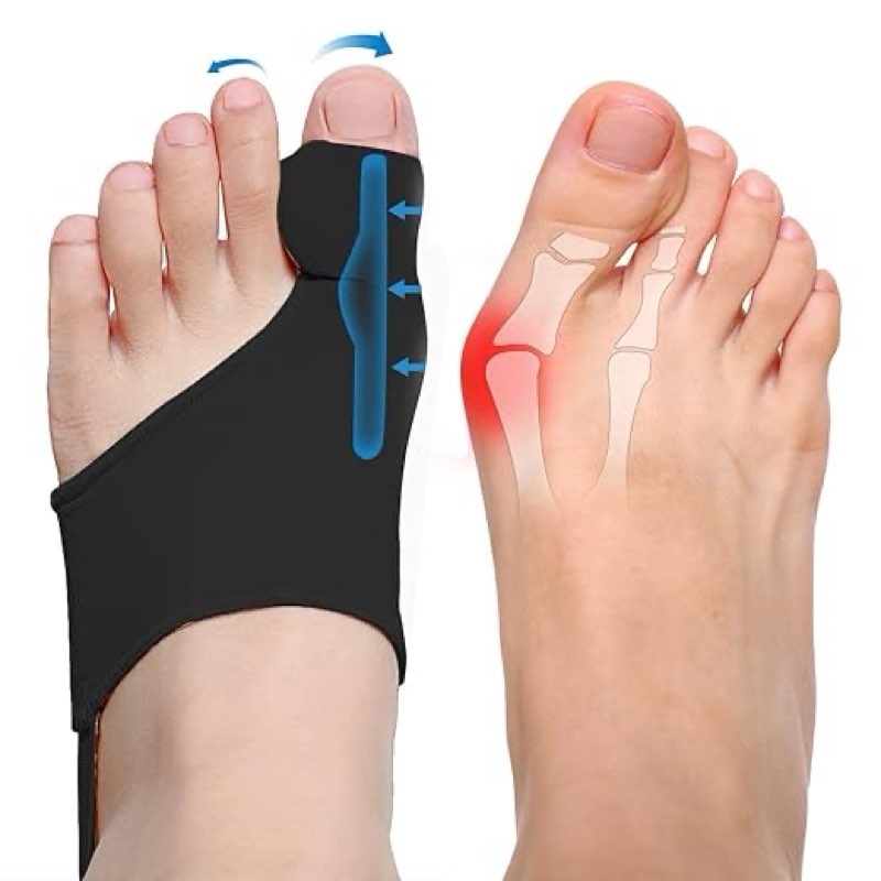 2-Pack Bunion Corrector for Women Big Toe Straightener Bunion Corrector for Men, Relief splints Redu