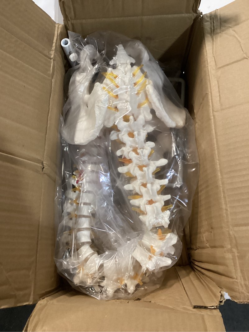Condition photo showing As Is for breesky Spine Model, 34.6" Life Size Spinal Cord Model Flexible Anatomical Spine with Vertebrae, Nerves, Arteries, Lumbar Column, and Male Pelvis with Stand for Science Study or Patient Education